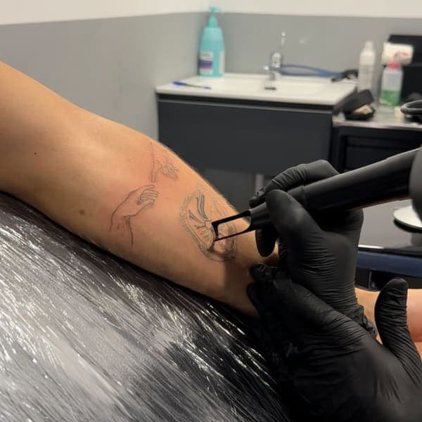 Antes y después — eliminación de microblading